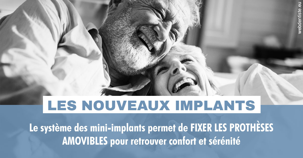https://selarl-dr-wenger-daniel.chirurgiens-dentistes.fr/Les nouveaux implants 2