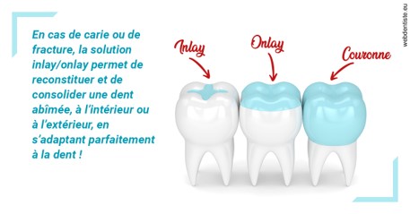 https://selarl-dr-wenger-daniel.chirurgiens-dentistes.fr/L'INLAY ou l'ONLAY