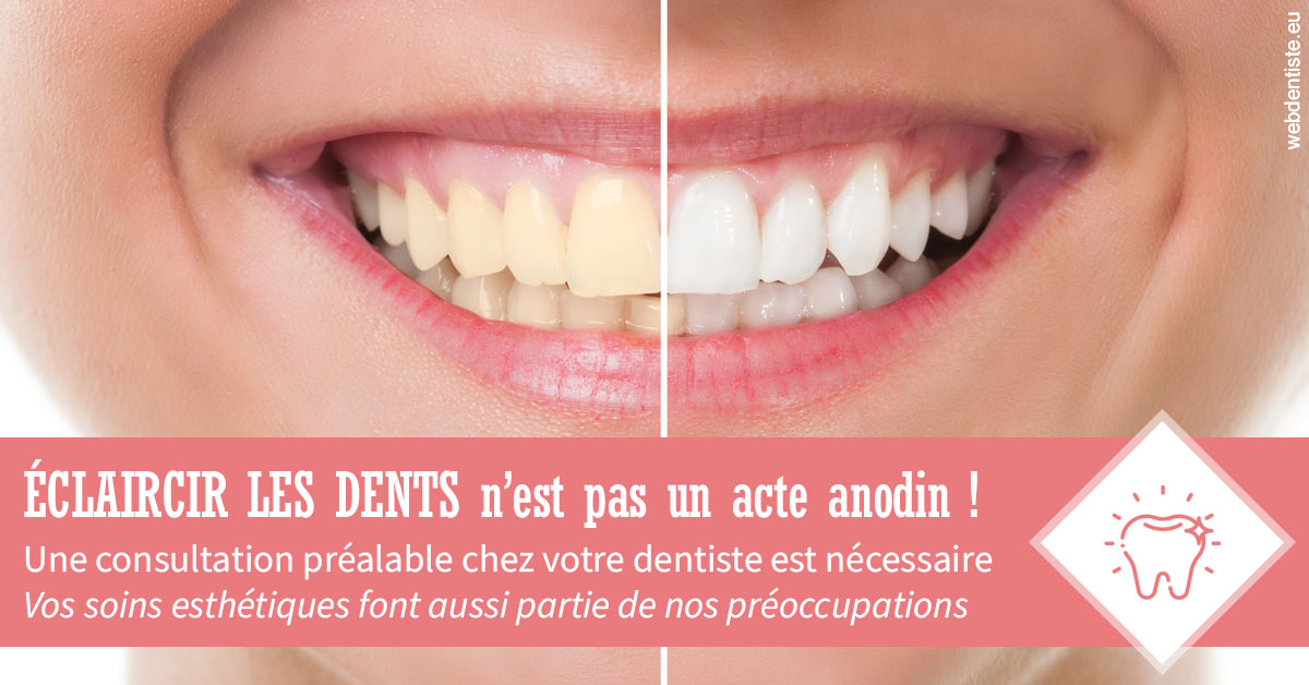 https://selarl-dr-wenger-daniel.chirurgiens-dentistes.fr/Eclaircir les dents 1