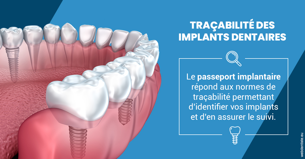 https://selarl-dr-wenger-daniel.chirurgiens-dentistes.fr/T2 2023 - Traçabilité des implants 1