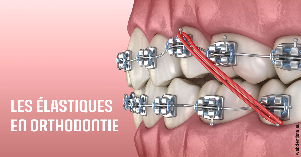 https://selarl-dr-wenger-daniel.chirurgiens-dentistes.fr/Elastiques orthodontie 2