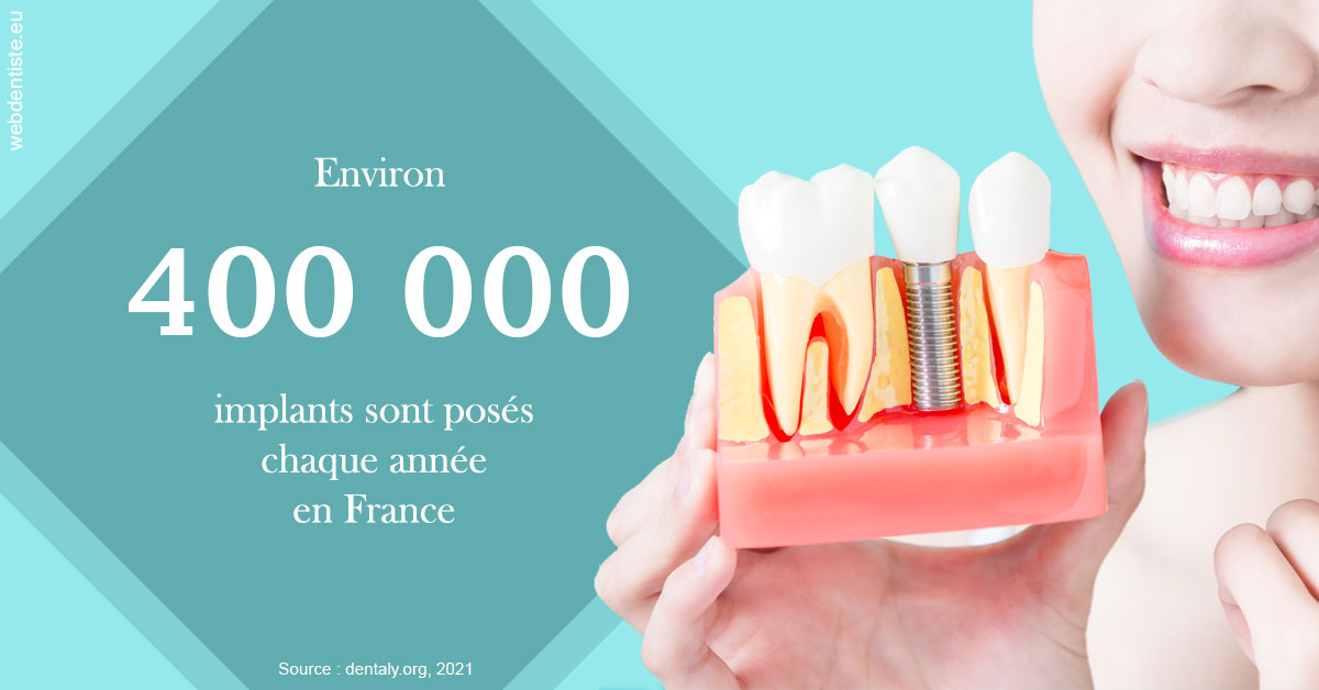 https://selarl-dr-wenger-daniel.chirurgiens-dentistes.fr/Pose d'implants en France 2